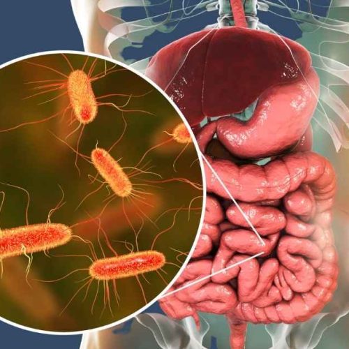 intestino osteoporosi
